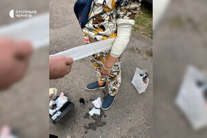 An ammunition detonated at an exhibition in Chernihiv: three children were injured